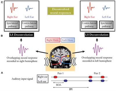 Deconvolution of Ears' Activity (DEA): A New Experimental Paradigm to Investigate Central Auditory Processing